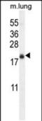 Transmembrane Protein 80 antibody, PA5-48331, Invitrogen Antibodies, Western Blot image 