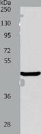 AlkB Homolog 1, Histone H2A Dioxygenase antibody, TA321739, Origene, Western Blot image 