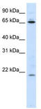 Nucleolar Pre-RRNA Processing Protein NIP7 antibody, TA343841, Origene, Western Blot image 