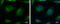 Calcium Voltage-Gated Channel Auxiliary Subunit Beta 4 antibody, GTX100202, GeneTex, Immunofluorescence image 