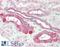 TNF Receptor Superfamily Member 14 antibody, 45-753, ProSci, Enzyme Linked Immunosorbent Assay image 