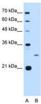 Aspartate Beta-Hydroxylase antibody, TA339207, Origene, Western Blot image 