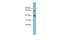 Transmembrane 9 Superfamily Member 4 antibody, A13778, Boster Biological Technology, Western Blot image 