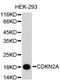 Cyclin-dependent kinase inhibitor 2A, isoforms 1/2/3 antibody, abx127104, Abbexa, Western Blot image 
