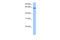 Tetratricopeptide Repeat Domain 6 antibody, 30-417, ProSci, Western Blot image 