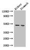 Fumarylacetoacetate Hydrolase antibody, CSB-PA007965LA01HU, Cusabio, Western Blot image 