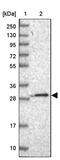 Transmembrane Protein 134 antibody, PA5-60492, Invitrogen Antibodies, Western Blot image 