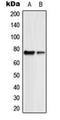 Guanylate cyclase soluble subunit beta-2 antibody, orb216121, Biorbyt, Western Blot image 