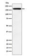 Podocalyxin Like antibody, M03359-1, Boster Biological Technology, Western Blot image 