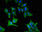 G Protein Subunit Alpha Transducin 1 antibody, LS-C678109, Lifespan Biosciences, Immunofluorescence image 