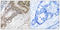 Forkhead Box O3 antibody, LS-C198978, Lifespan Biosciences, Immunohistochemistry paraffin image 