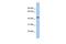 Potassium Channel Tetramerization Domain Containing 10 antibody, GTX47647, GeneTex, Western Blot image 