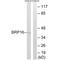 HGH1 Homolog antibody, A13420, Boster Biological Technology, Western Blot image 