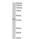 TATA-Box Binding Protein antibody, NBP2-12933, Novus Biologicals, Western Blot image 