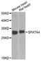 Spermatogenesis Associated 4 antibody, A7608, ABclonal Technology, Western Blot image 