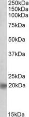 Achaete-Scute Family BHLH Transcription Factor 3 antibody, TA311485, Origene, Western Blot image 