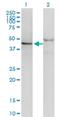 Splicing Factor 3b Subunit 4 antibody, H00010262-M03, Novus Biologicals, Western Blot image 