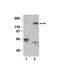 Protein Phosphatase 1 Regulatory Subunit 12A antibody, NBP2-29680, Novus Biologicals, Western Blot image 