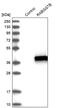 Rab Geranylgeranyltransferase Subunit Beta antibody, PA5-55531, Invitrogen Antibodies, Western Blot image 