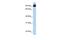 Engulfment and cell motility protein 3 antibody, GTX49014, GeneTex, Western Blot image 