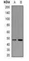 Proteasome 26S Subunit, Non-ATPase 4 antibody, abx141580, Abbexa, Western Blot image 