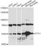 ETV1 antibody, A7184, ABclonal Technology, Western Blot image 