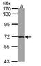 Citrin antibody, TA308212, Origene, Western Blot image 