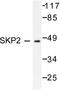 S-Phase Kinase Associated Protein 2 antibody, LS-C176209, Lifespan Biosciences, Western Blot image 