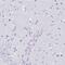 DDB1 And CUL4 Associated Factor 17 antibody, NBP2-30590, Novus Biologicals, Immunohistochemistry paraffin image 