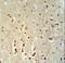 PTOV1 Extended AT-Hook Containing Adaptor Protein antibody, LS-C162293, Lifespan Biosciences, Immunohistochemistry paraffin image 