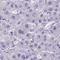 Thioredoxin reductase 3 intronic transcript 1 antibody, HPA058257, Atlas Antibodies, Immunohistochemistry frozen image 