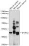 Interleukin 13 Receptor Subunit Alpha 2 antibody, GTX54375, GeneTex, Western Blot image 