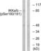 Component Of Inhibitor Of Nuclear Factor Kappa B Kinase Complex antibody, LS-C199103, Lifespan Biosciences, Western Blot image 