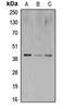 CAMP Responsive Element Binding Protein 1 antibody, MBS822128, MyBioSource, Western Blot image 