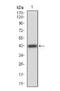 Erb-B2 Receptor Tyrosine Kinase 4 antibody, NBP2-52462, Novus Biologicals, Western Blot image 