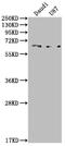 Activin A Receptor Like Type 1 antibody, CSB-RA555022A0HU, Cusabio, Western Blot image 