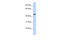 Zinc Finger Protein 239 antibody, 25-385, ProSci, Enzyme Linked Immunosorbent Assay image 