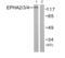 EPH Receptor A2 antibody, abx012815, Abbexa, Western Blot image 