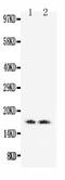 Myoglobin antibody, PA1826, Boster Biological Technology, Western Blot image 