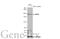 Myosin Heavy Chain 9 antibody, GTX633295, GeneTex, Western Blot image 