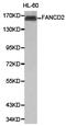 FA Complementation Group D2 antibody, LS-C192773, Lifespan Biosciences, Western Blot image 