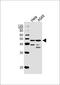 Nuclear Factor I C antibody, 58-230, ProSci, Western Blot image 