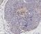 Fms Related Tyrosine Kinase 1 antibody, GTX30653, GeneTex, Immunohistochemistry paraffin image 