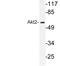 AKT Serine/Threonine Kinase 2 antibody, LS-C177636, Lifespan Biosciences, Western Blot image 