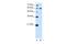 Deltex E3 Ubiquitin Ligase 2 antibody, 29-852, ProSci, Enzyme Linked Immunosorbent Assay image 