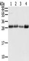 Transmembrane P24 Trafficking Protein 1 antibody, TA350514, Origene, Western Blot image 