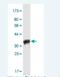 Pannexin 2 antibody, H00056666-M02-100ug, Novus Biologicals, Western Blot image 