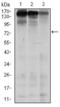 MutS Homolog 6 antibody, STJ98124, St John