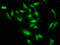 Distal-Less Homeobox 1 antibody, LS-C670414, Lifespan Biosciences, Immunofluorescence image 