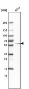 Dual Specificity Tyrosine Phosphorylation Regulated Kinase 2 antibody, NBP1-89516, Novus Biologicals, Western Blot image 